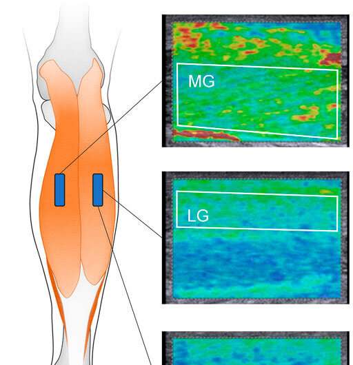 Se muscler : Relier les raideurs musculaires et articulaires des membres humains inférieurs