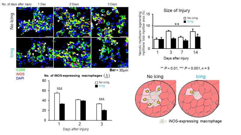 Glacer ou ne pas glacer ?  Le glaçage favorise la régénération musculaire après une blessure légère